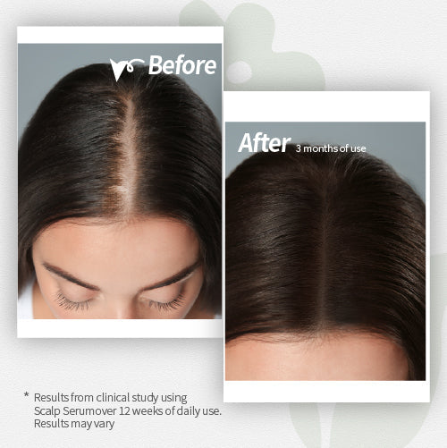 Fast Stop Hair Loss: How Dorpang Scalp Serum Delivers Real Results