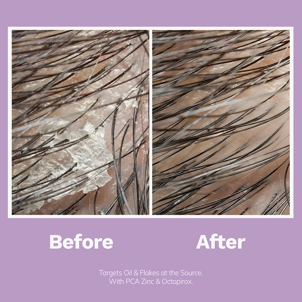 Refresh Shampoo