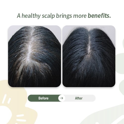 hair-loss-treatment-before-and -after-compare