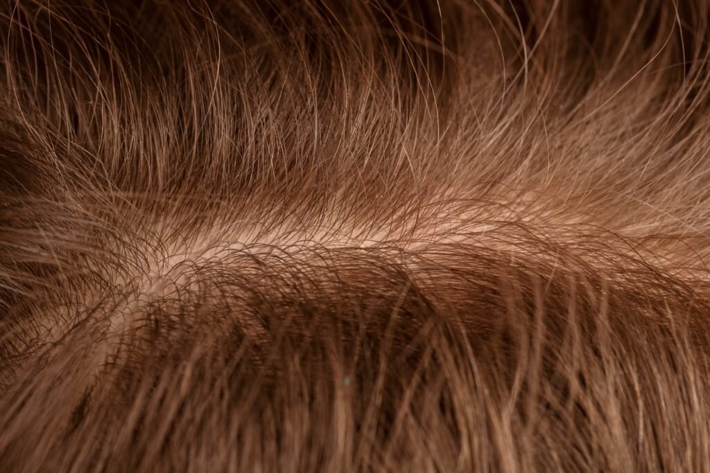 close-up-scalp-with-hair-loss-problems
