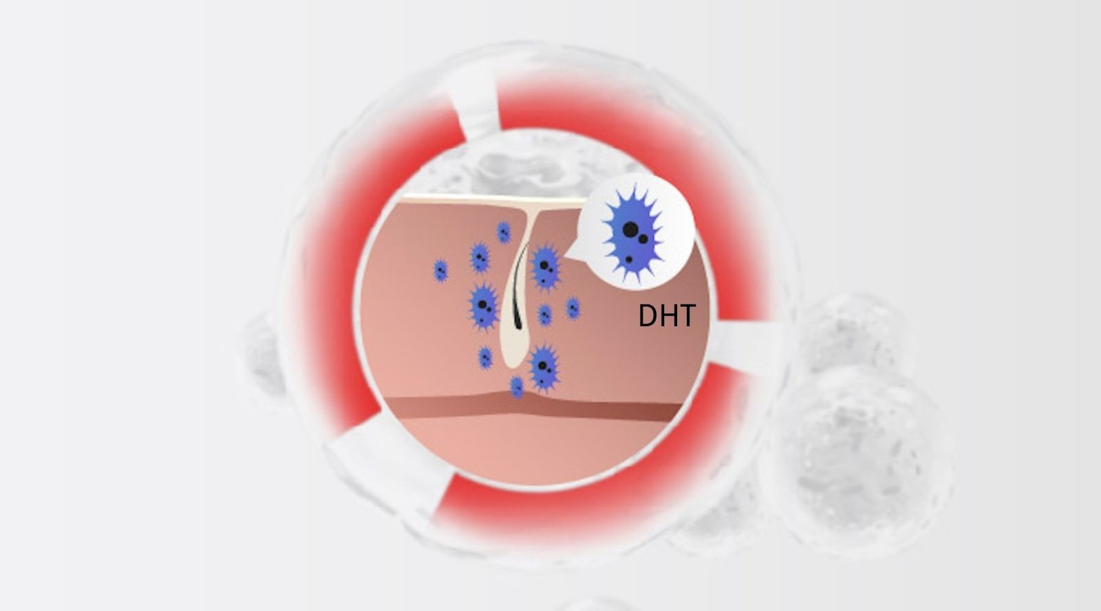 hair-loss-caused-by-DHT-damaged