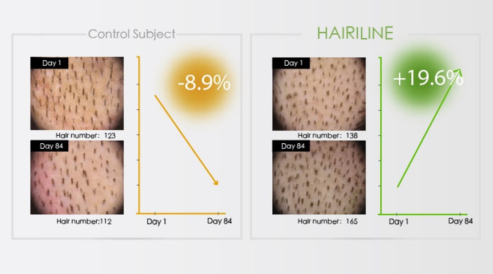 hairrline-helps-hair-growth